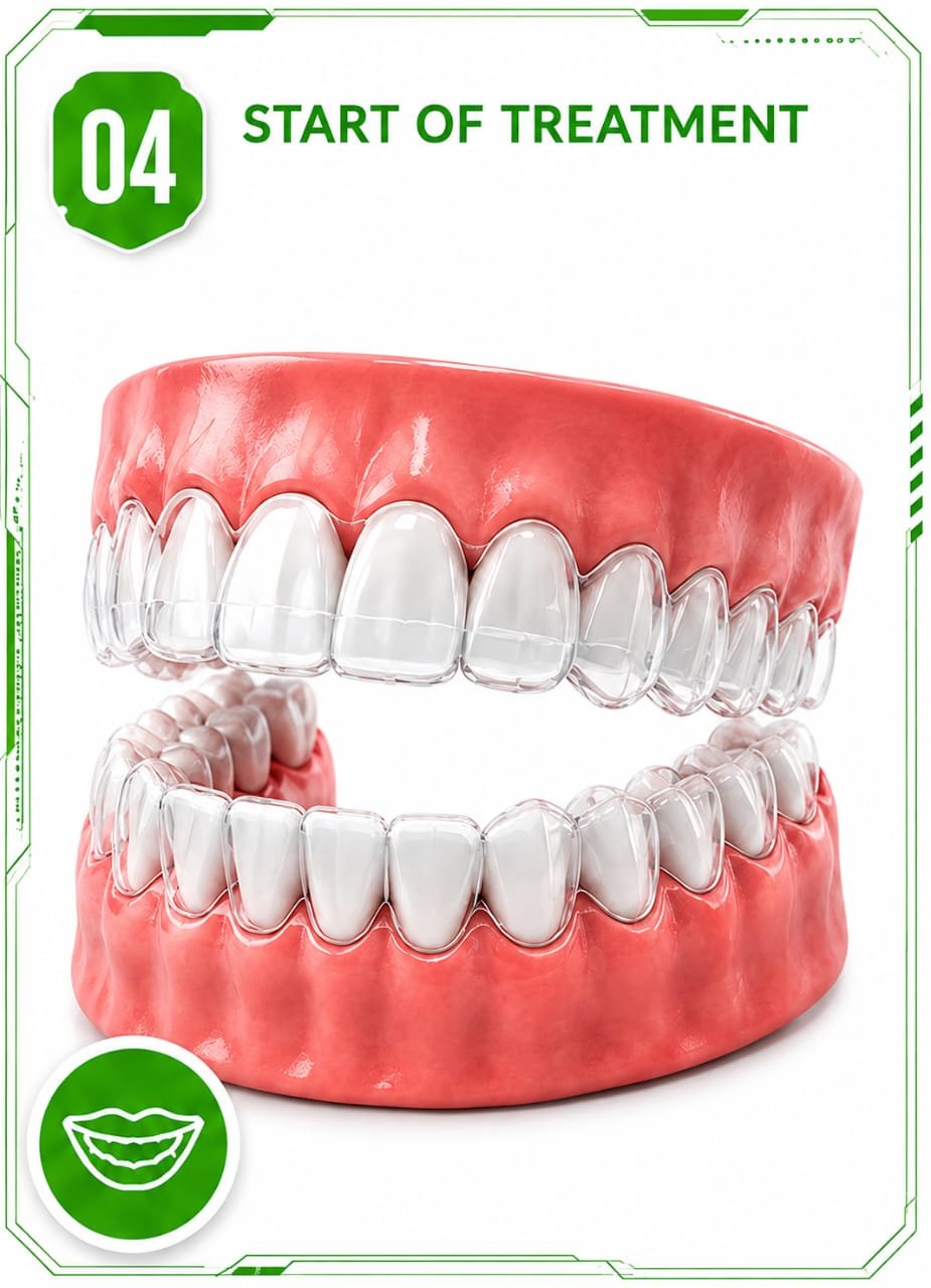 Insivible Aligners Process Image 04